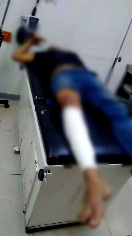 Joven motociclista sobrevive a fuerte choque en Apatzingán