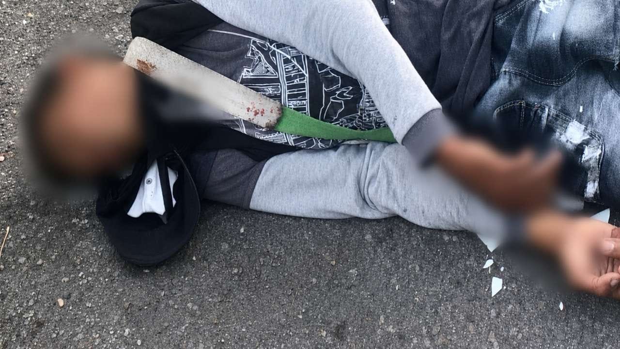 Automovilista embiste a motociclista y escapa; joven es hospitalizado en Apatzingán
